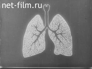 Footage Tuberculosis and its hunt for victims. (1910-1920)