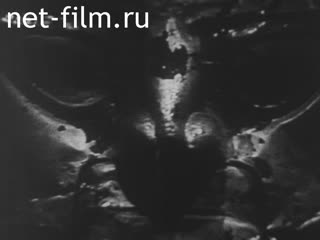 Новости Зарубежные киносюжеты №5550 (1978)