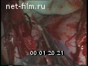 Footage frame