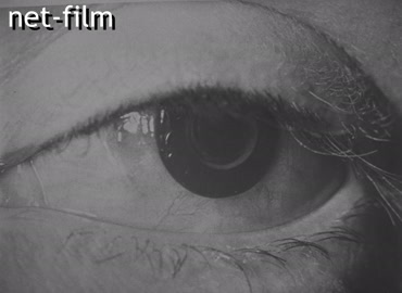 Кинохроника Микрохирургия глаза. (1986-1989)