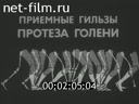 Изготовление приёмных гильз протезов нижних конечностей