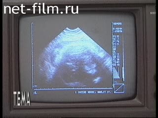 Телепередача Тема (1995 №1) 03.11.1995.