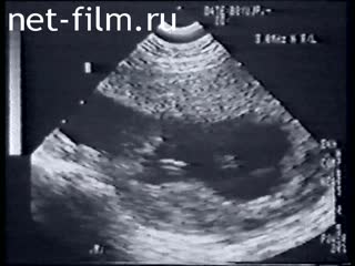 Footage Abortions. (2004)