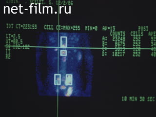 Movie Diagnosis and treatment of tumors of the musculoskeletal system. (1987)